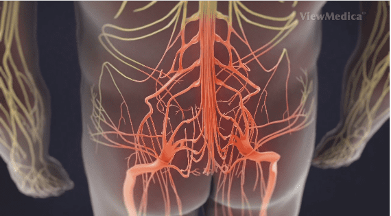 Lumbar-Radiculopathy