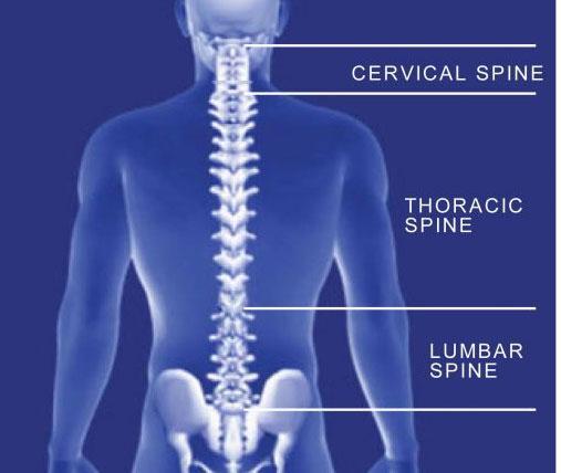 Spondylosis