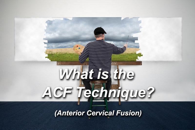 acf-technique