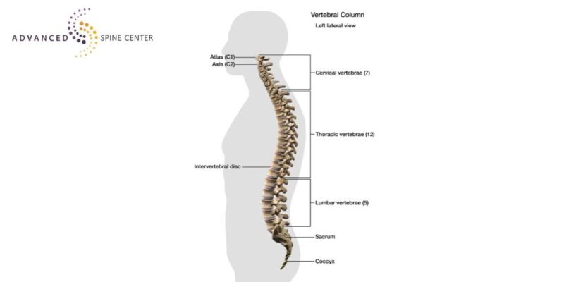 lumbar fusion surgery plano