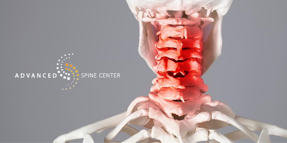 cervical fusion surgery frisco