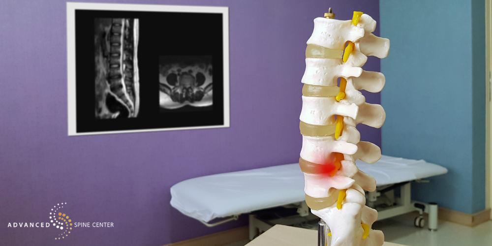 spine surgery in allen tx