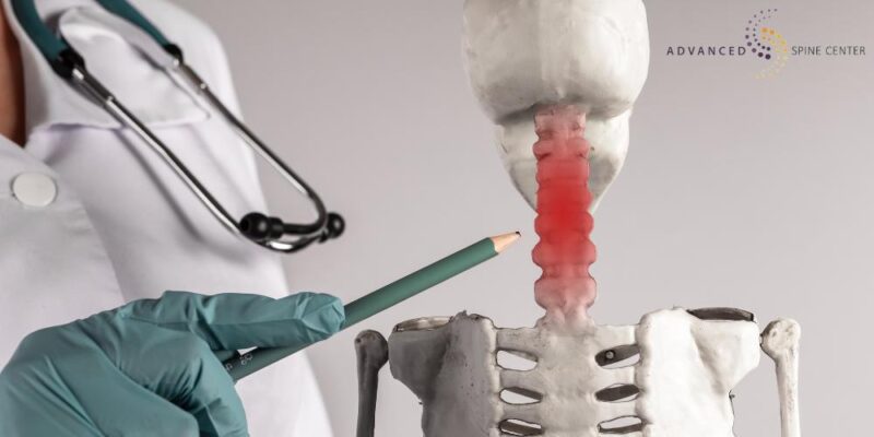 Cervical Herniated Disc Treatment Plano, TX | Advanced Spine Center