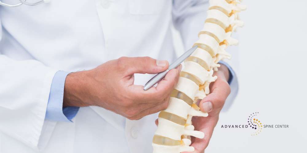 radiculopathy vs sciatica