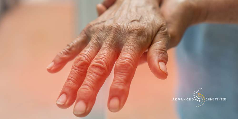 what does radiculopathy mean