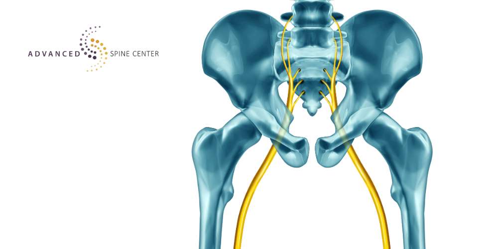 Sciatica Treatment in Plano, TX