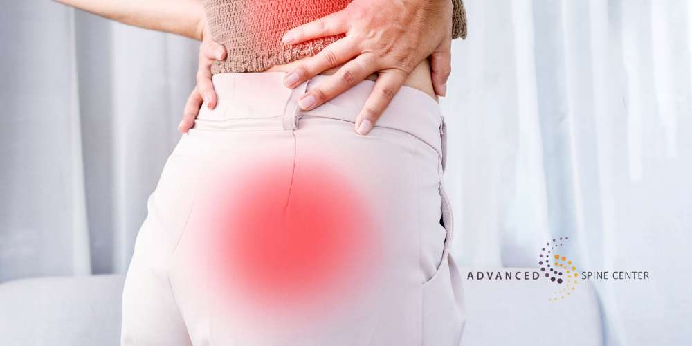 Sciatica Treatment Plano
