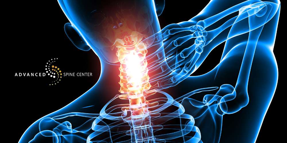 Cervical Spine Surgery Plano