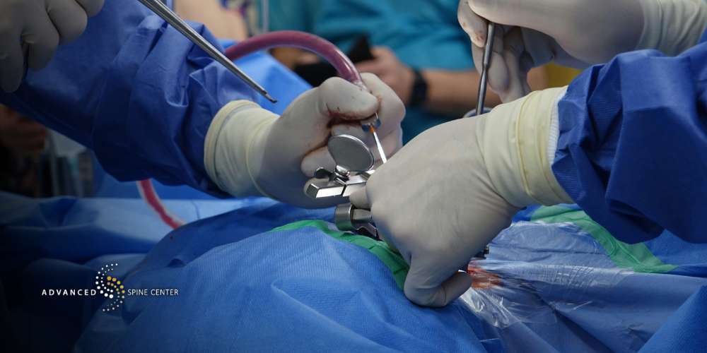 Hemilaminectomy Plano, TX