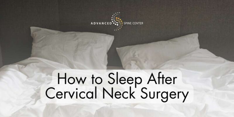 How to Sleep After Cervical Neck Surgery
