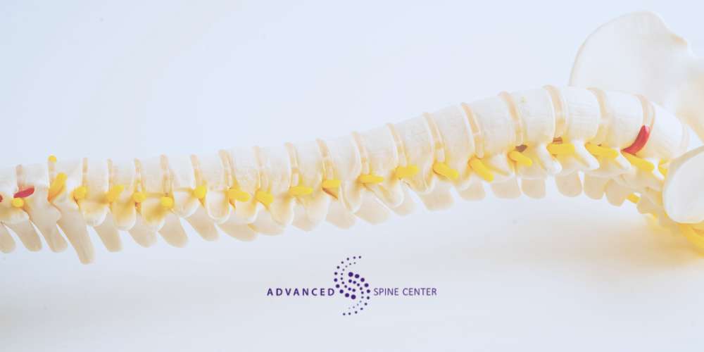 Spine Surgery FAQ