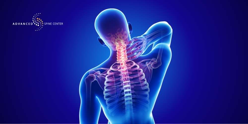 Uncovertebral Joint Hypertrophy Treatment in Plano, TX