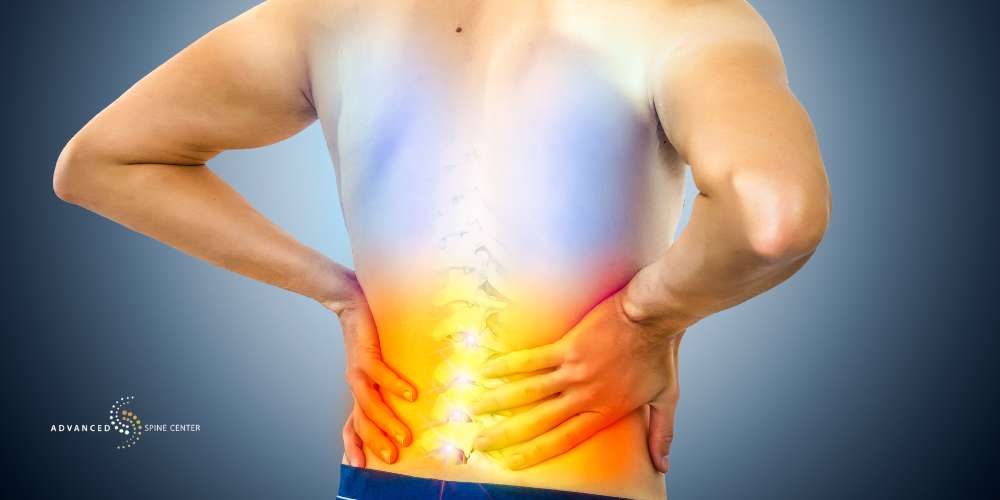 cauda equina syndrome treatment without surgery plano tx