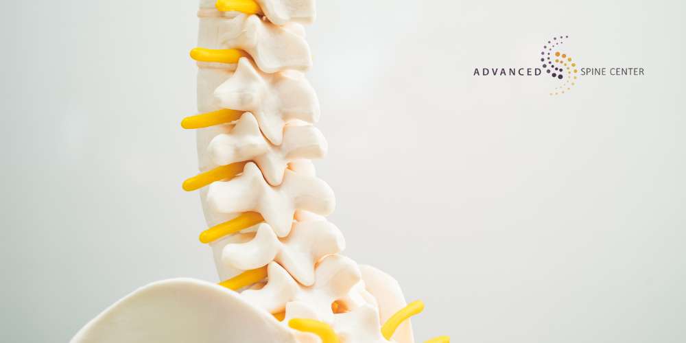 spinal stenosis