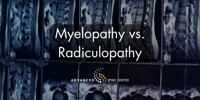 Myelopathy vs. Radiculopathy