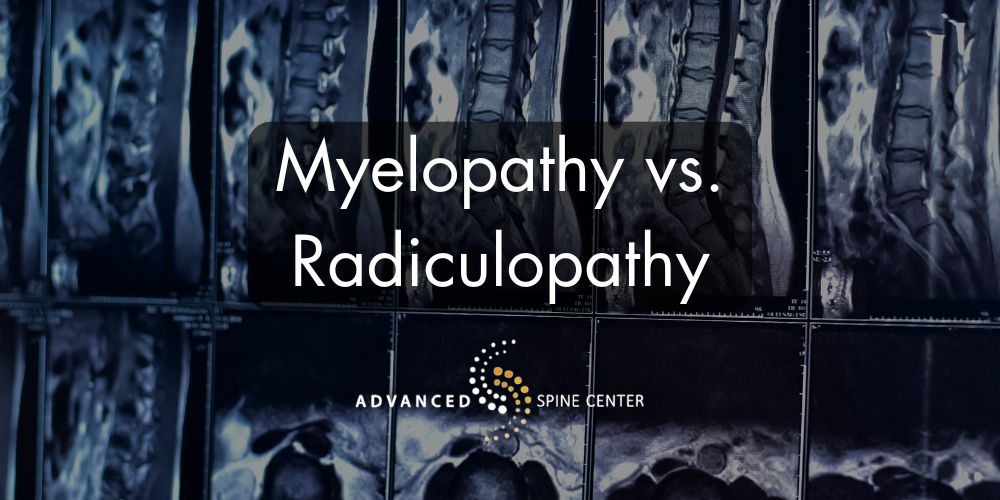 Myelopathy vs. Radiculopathy