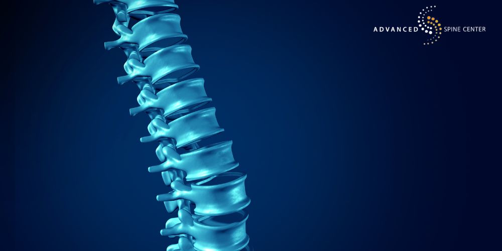thoracic myelopathy treatment