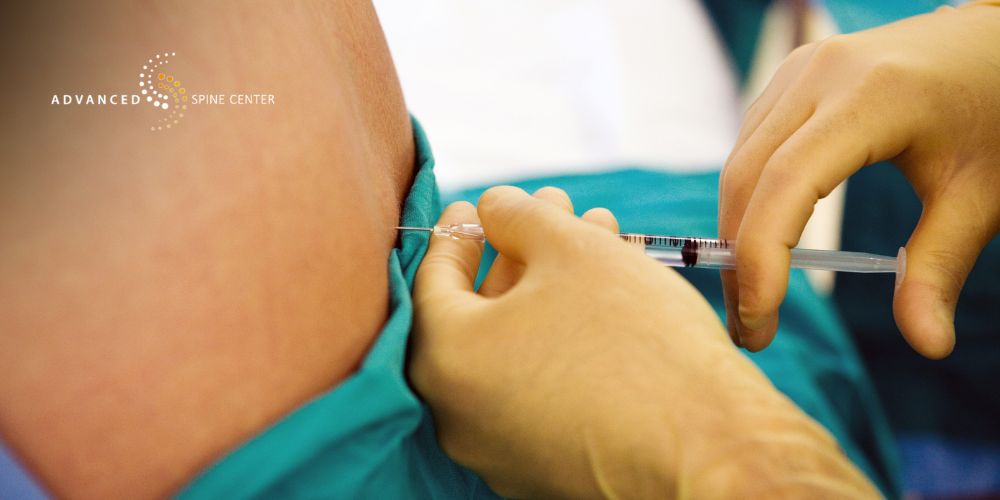 lumbar transforaminal epidural steroid injection in plano ,tx