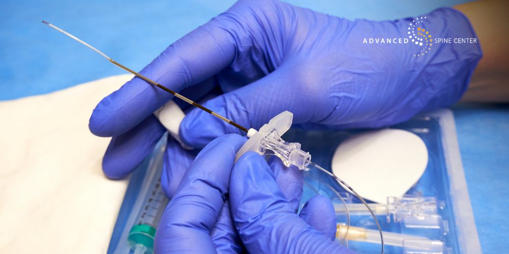 lumbar transforaminal epidural steroid injection