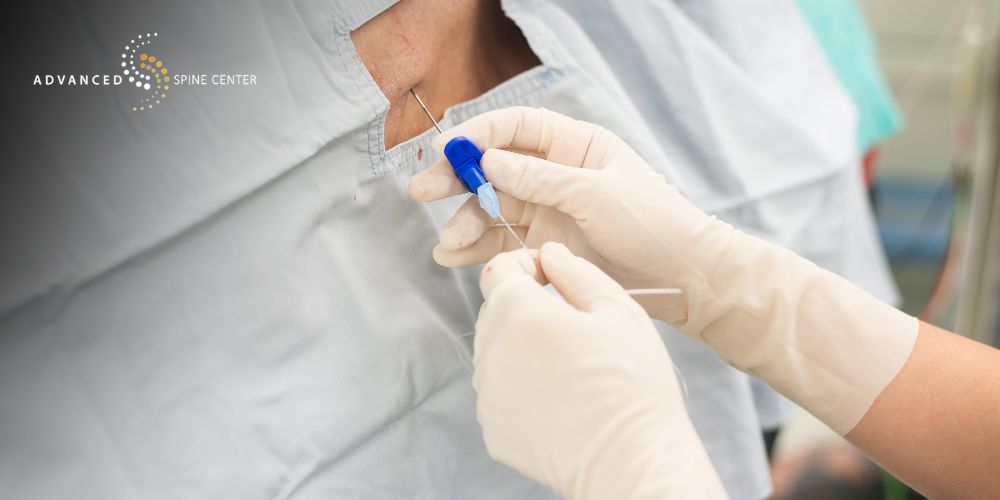 plano, tx lumbar transforaminal epidural steroid injection