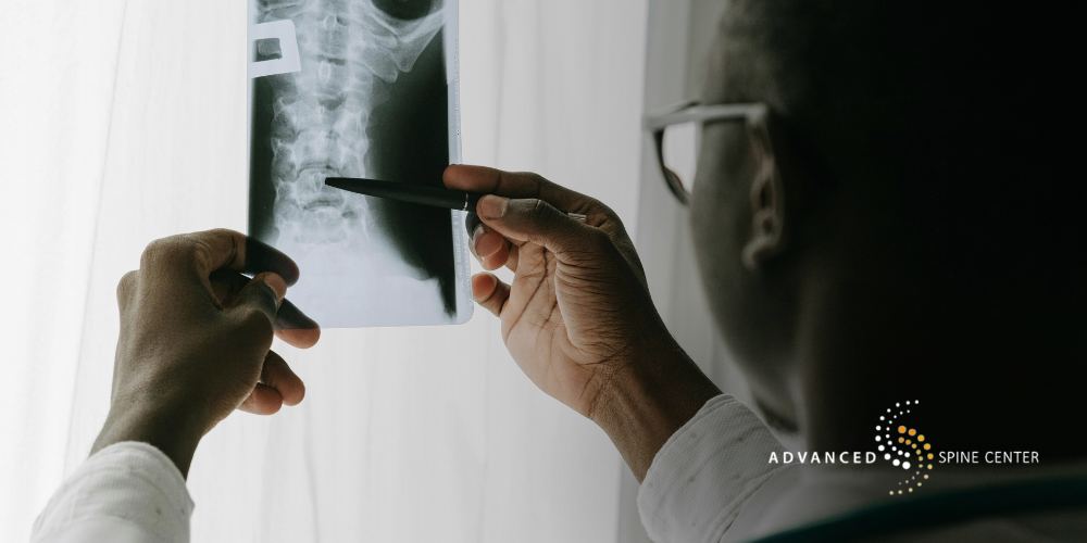 plano spinal decompression surgery