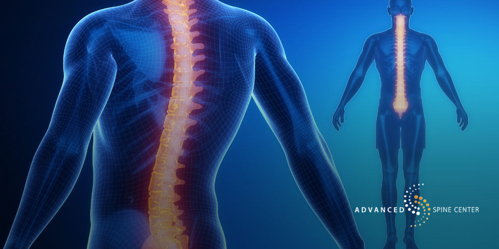 plano texas spinal decompression surgery