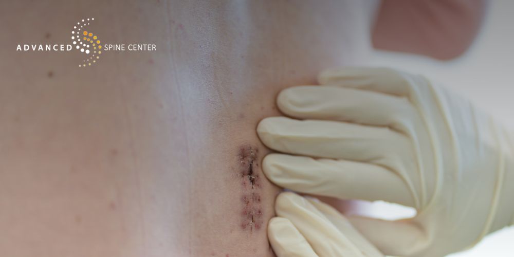 thoracic radiculopathy treatment plano tx