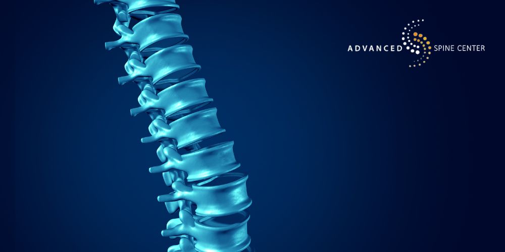 thoracic radiculopathy treatment