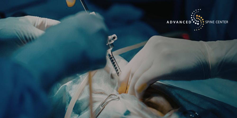 foraminotomy in plano, tx