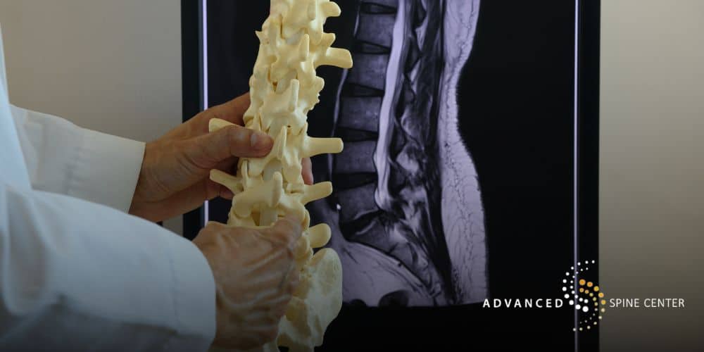 nerve block injection plano tx
