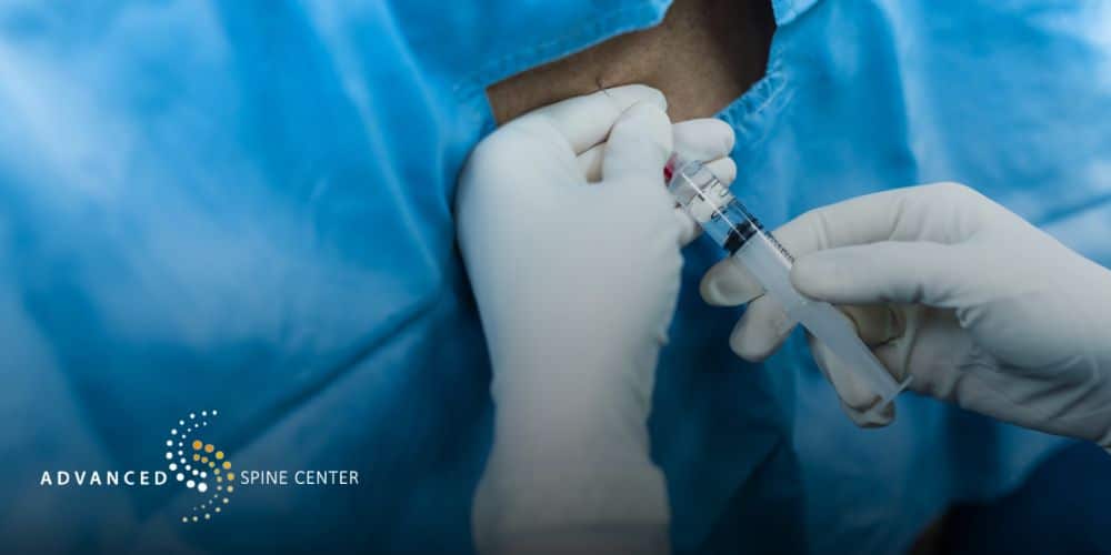 nerve block injection