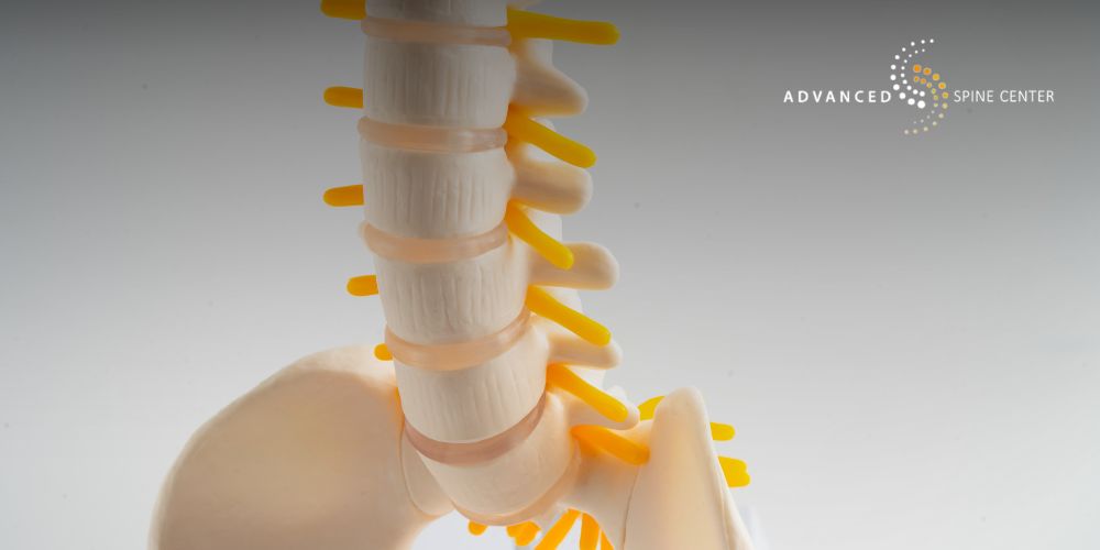 plano facet joint injection